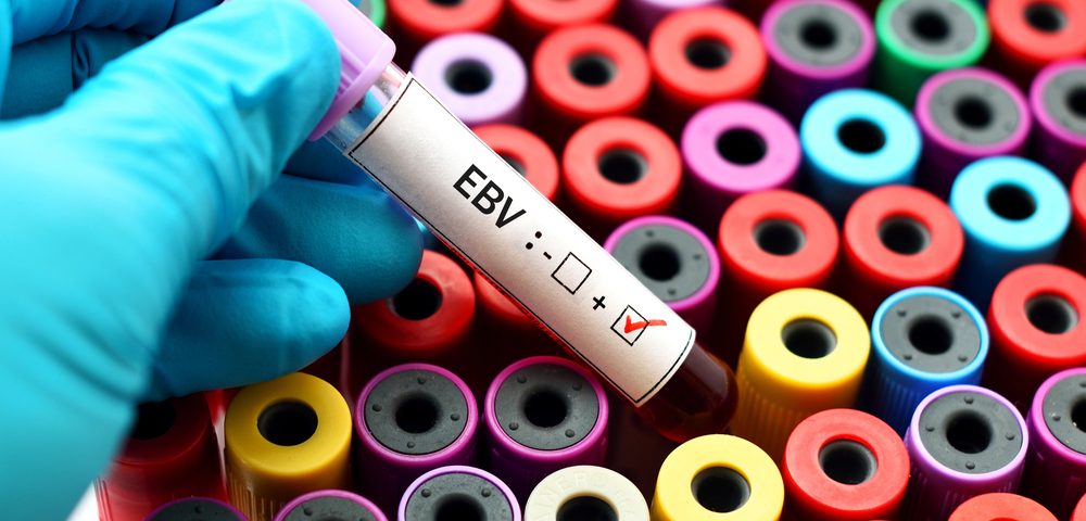 Epstein-Barr Increases JIA Disease Activity, Impairs Treatment Response, Study Finds